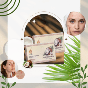 ผิวใสไร้กังวล แค่มีสบู่น้ำมันมะพร้าวนมข้าว